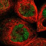 Ubinuclein 2 Polyclonal Antibody