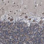 DDX56 Antibody in Immunohistochemistry (Paraffin) (IHC (P))