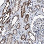 DDX56 Antibody in Immunohistochemistry (Paraffin) (IHC (P))