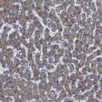 DDX56 Antibody in Immunohistochemistry (Paraffin) (IHC (P))