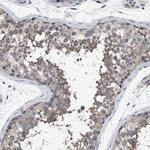DDX56 Antibody in Immunohistochemistry (Paraffin) (IHC (P))
