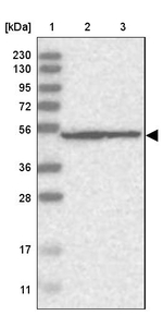 DDX56 Antibody in Western Blot (WB)
