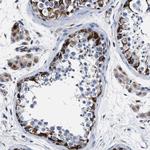 OR10G3 Polyclonal Antibody