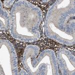 Tara Antibody in Immunohistochemistry (Paraffin) (IHC (P))