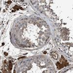 Tara Antibody in Immunohistochemistry (Paraffin) (IHC (P))
