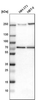 Tara Antibody in Western Blot (WB)