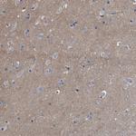 FAM171A2 Antibody in Immunohistochemistry (Paraffin) (IHC (P))