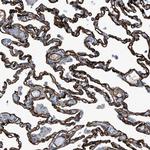 SLC22A15 Antibody in Immunohistochemistry (Paraffin) (IHC (P))