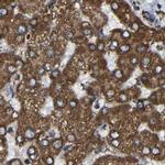 NDUFV3 Antibody in Immunohistochemistry (IHC)