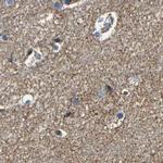 NDUFV3 Antibody in Immunohistochemistry (IHC)