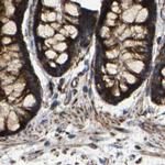 NDUFV3 Antibody in Immunohistochemistry (IHC)