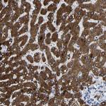 CCDC171 Polyclonal Antibody