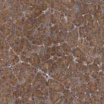 UBAP1 Antibody in Immunohistochemistry (Paraffin) (IHC (P))
