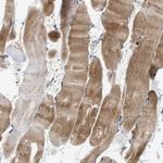 CCDC171 Polyclonal Antibody