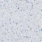HMHA1 Antibody in Immunohistochemistry (IHC)