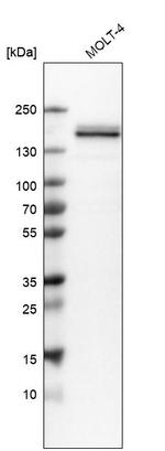 HMHA1 Antibody in Western Blot (WB)