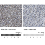RBM15 Antibody in Immunohistochemistry (Paraffin) (IHC (P))