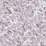 FTSJ2 Polyclonal Antibody