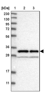 NUDT5 Antibody in Western Blot (WB)