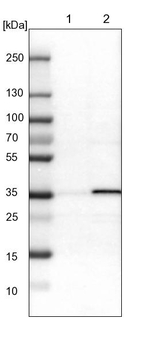 NUDT5 Antibody in Western Blot (WB)