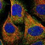 NAPE PLD Polyclonal Antibody