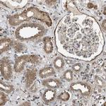 NAPE PLD Antibody in Immunohistochemistry (Paraffin) (IHC (P))
