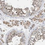 NAPE PLD Antibody in Immunohistochemistry (Paraffin) (IHC (P))