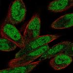 PHIP Polyclonal Antibody