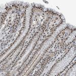 PHIP Antibody in Immunohistochemistry (Paraffin) (IHC (P))