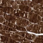 FITM1 Antibody in Immunohistochemistry (Paraffin) (IHC (P))