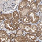 SSH1 Polyclonal Antibody