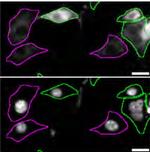 RAB27B Polyclonal Antibody