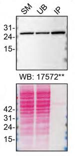 RAB27B Antibody in Immunoprecipitation (IP)