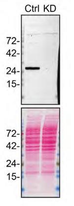 RAB27B Antibody in Western Blot (WB)