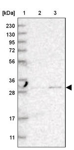TPMT Antibody in Western Blot (WB)