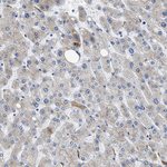 GC Polyclonal Antibody