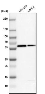 GC Antibody in Western Blot (WB)