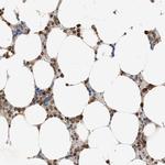 TRIM50 Polyclonal Antibody