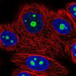NOM1 Antibody in Immunocytochemistry (ICC/IF)