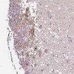 NOM1 Antibody in Immunohistochemistry (Paraffin) (IHC (P))