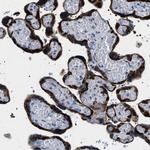 PHRF1 Polyclonal Antibody