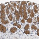 PPM1L Polyclonal Antibody
