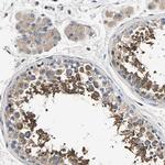 Bif1 Polyclonal Antibody