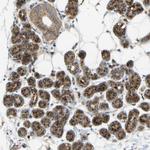 YIPF2 Antibody in Immunohistochemistry (Paraffin) (IHC (P))
