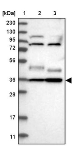 YIPF2 Antibody in Western Blot (WB)
