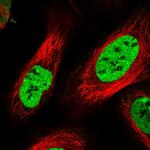 DBC1 Polyclonal Antibody