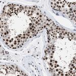 DBC1 Antibody in Immunohistochemistry (Paraffin) (IHC (P))
