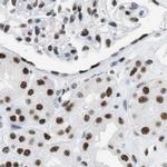 DBC1 Antibody in Immunohistochemistry (IHC)