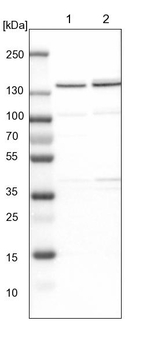 DBC1 Antibody in Western Blot (WB)