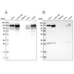 DBC1 Antibody in Western Blot (WB)